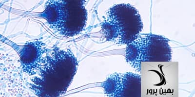 بررسی آسپرژیلوزیس از بیماری های شایع در شترمرغ